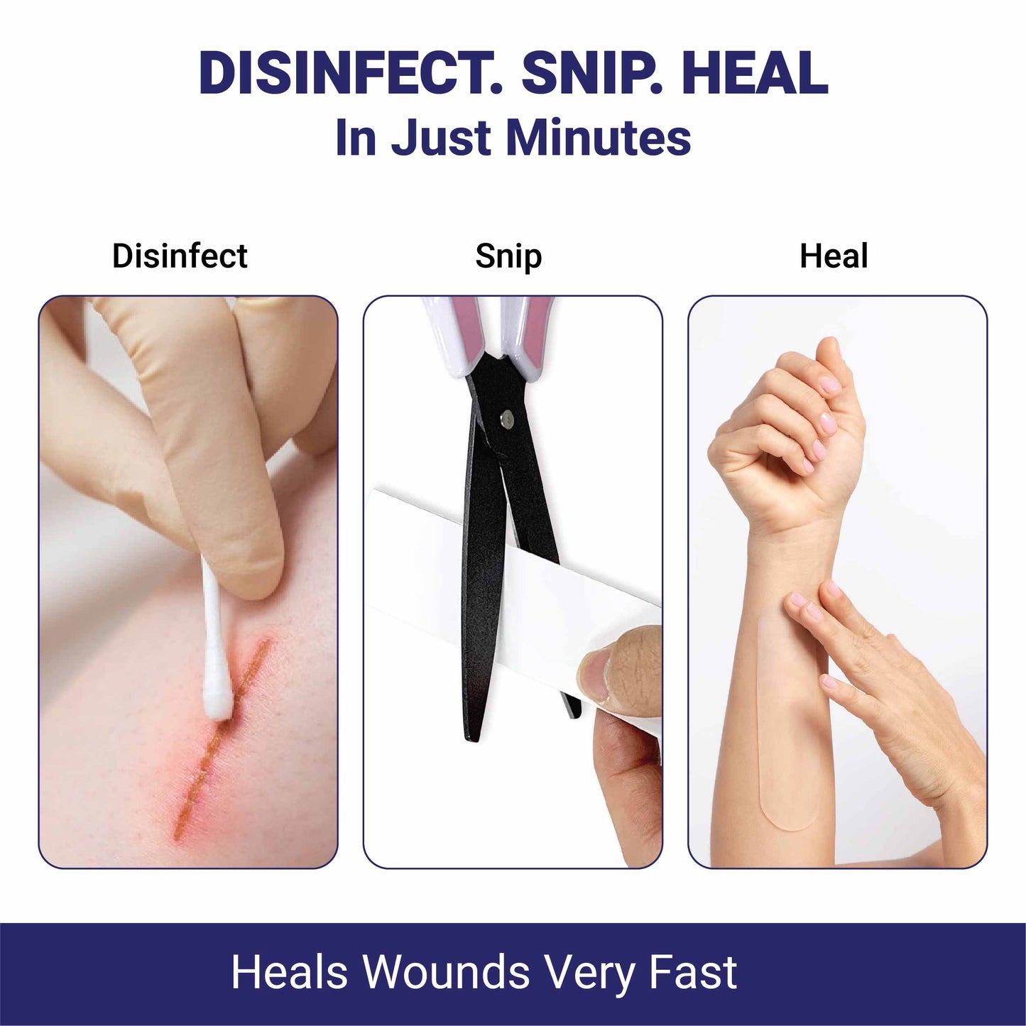 Recast Hydrocolloid Roll For Acne & Scarring