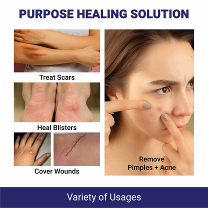 Recast Hydrocolloid Roll For Acne & Scarring