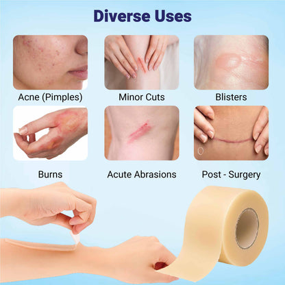 Recast Hydrocolloid Roll For Acne & Scarring